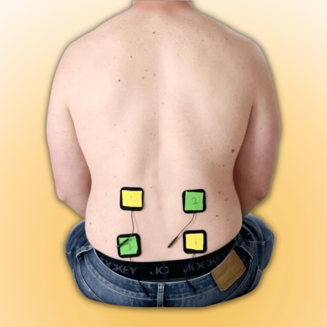 How to Use a TENS Unit With Low Back Pain. Correct Pad Placement